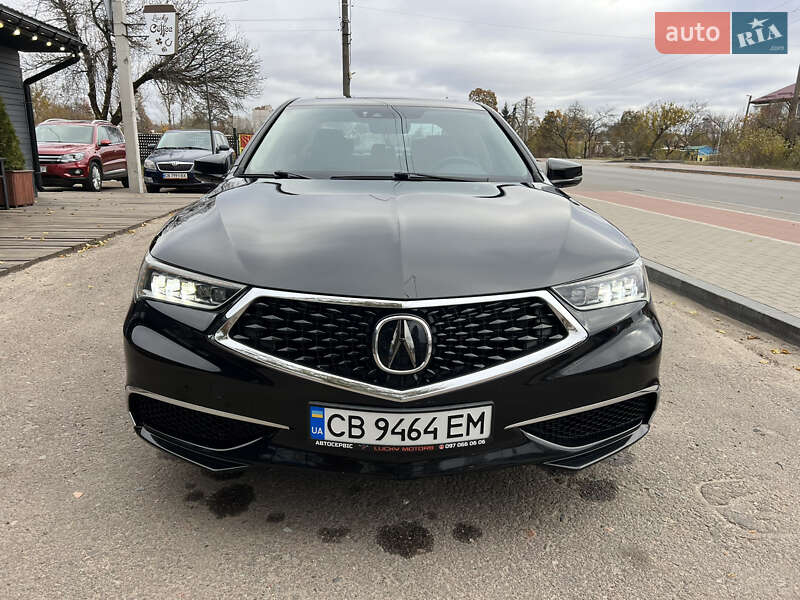Acura Tlx (2017)