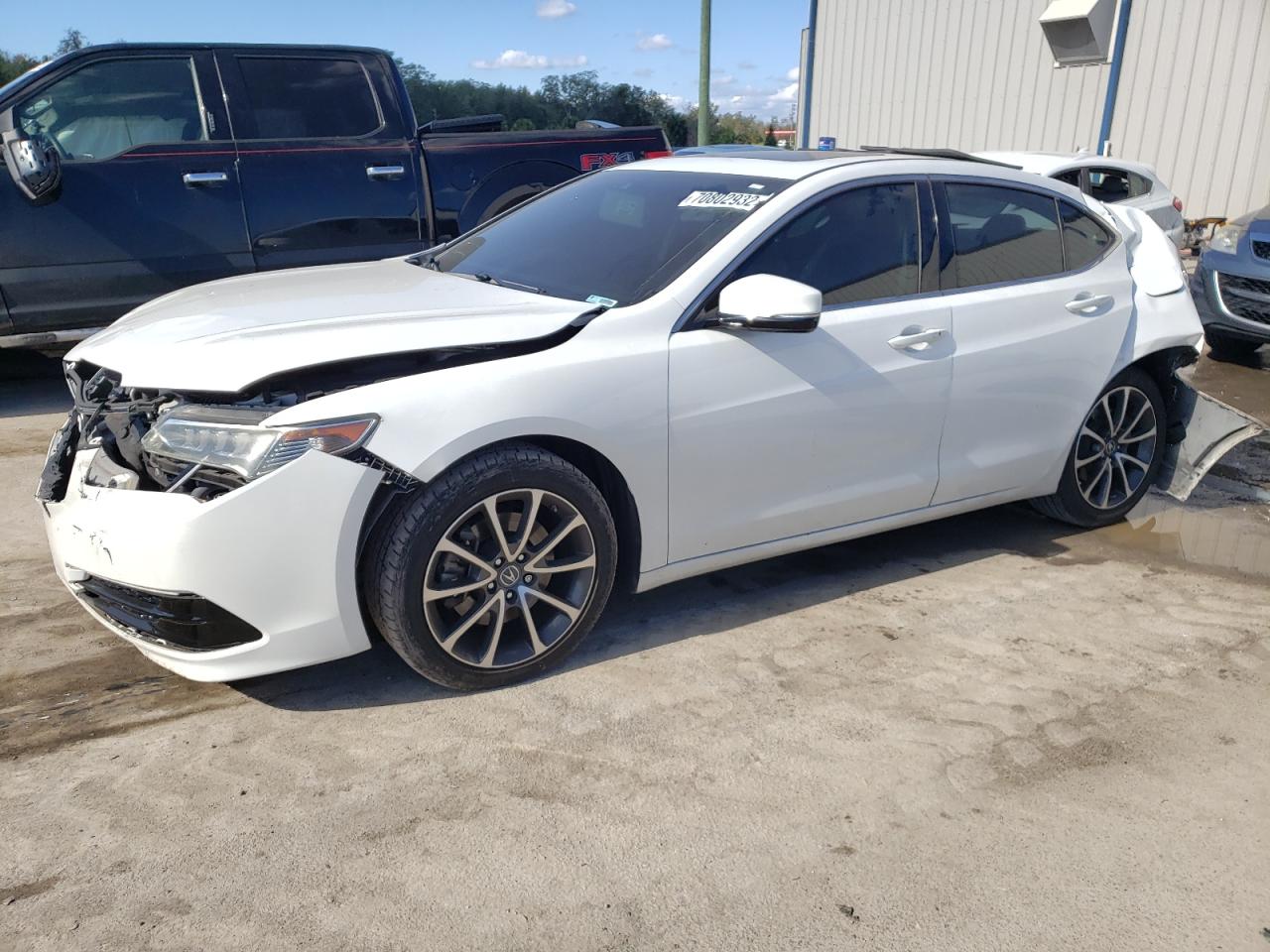 Acura Tlx tech (2016)