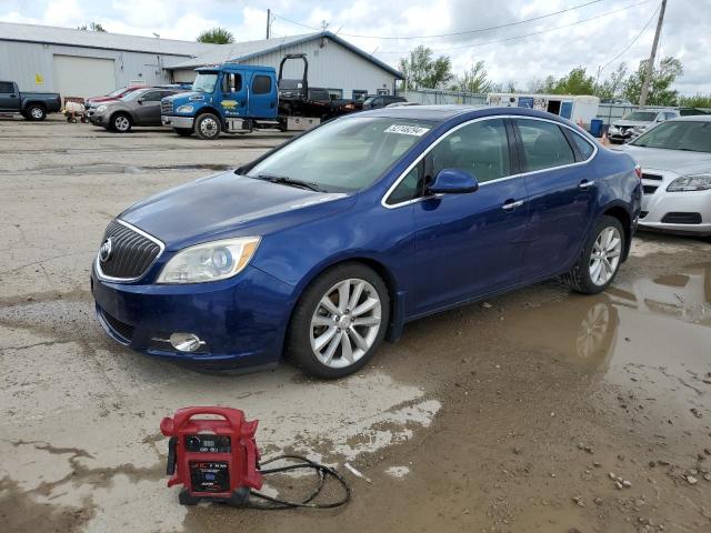 Buick Verano (2014)