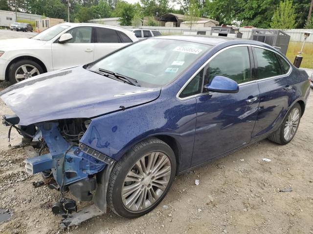 Buick Verano (2014)