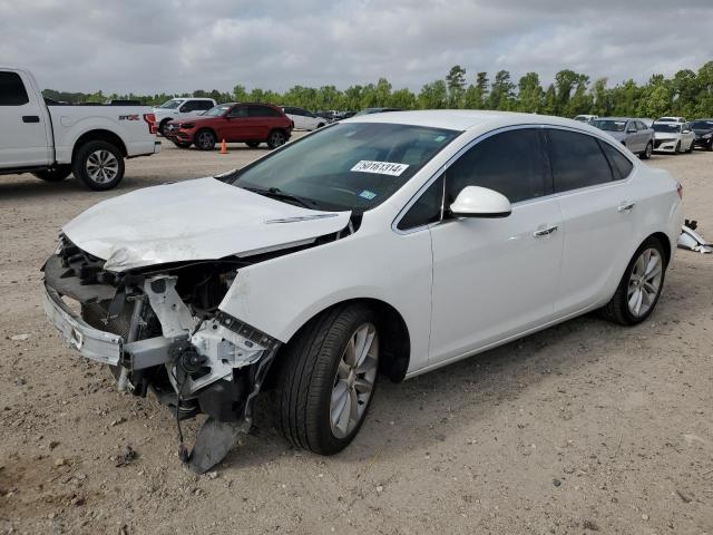 Buick Verano (2013)