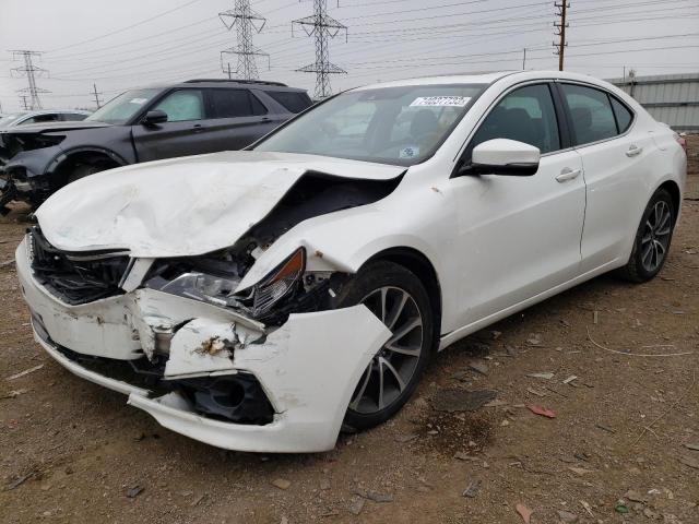 Acura Tlx advanc (2017)