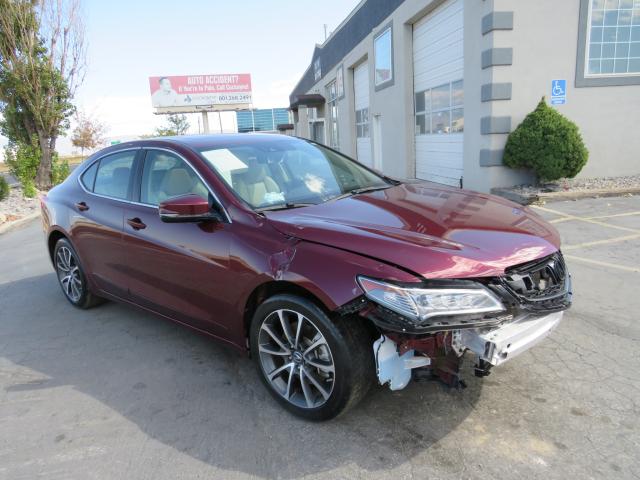 Acura Tlx advanc (2015)