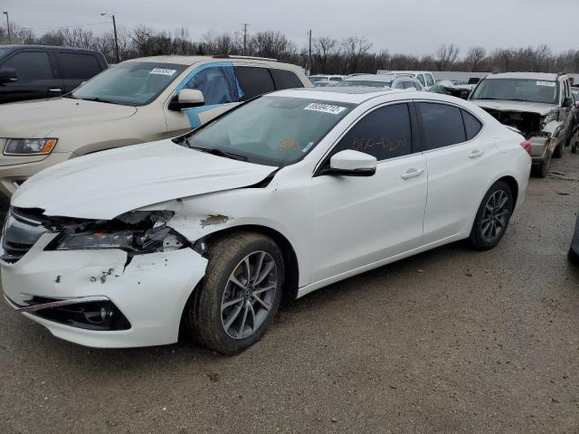 Acura Tlx advanc (2017)