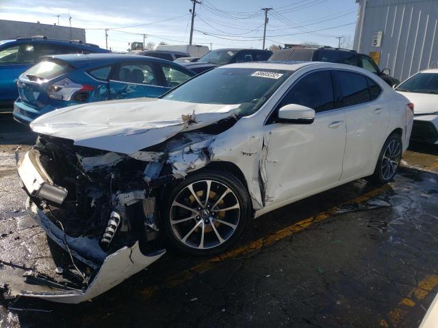 Acura Tlx advanc (2017)